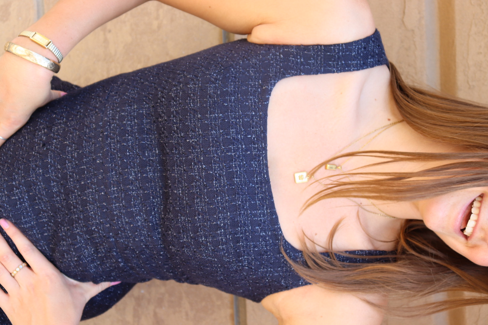 TORY BURCH DRESS view 9