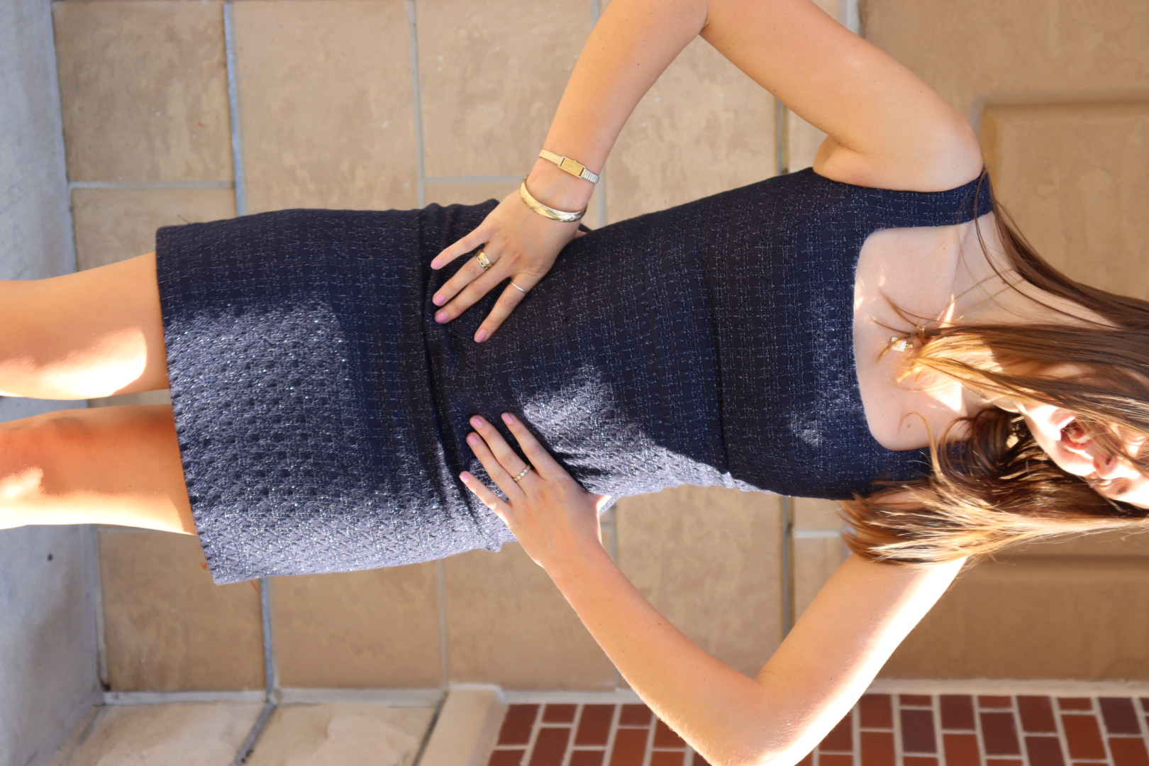 TORY BURCH DRESS view 13