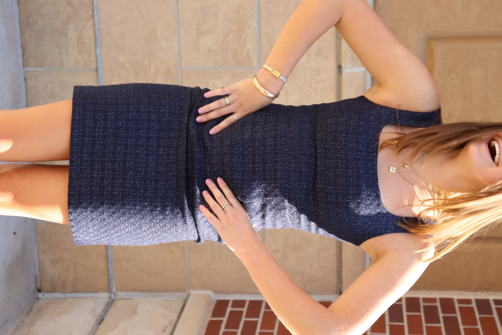 TORY BURCH DRESS view 14