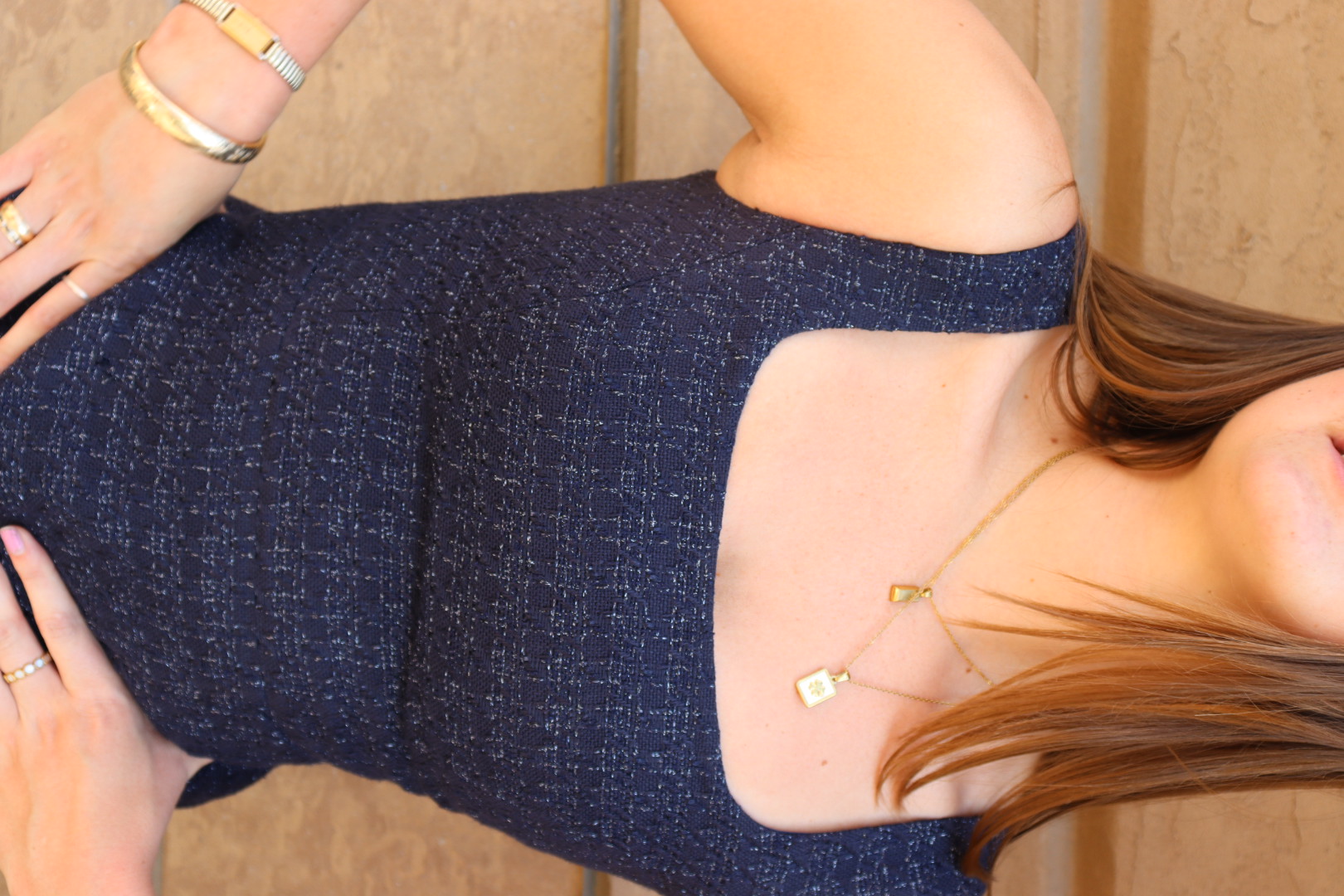 TORY BURCH DRESS view 17